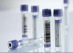 Vacuette® Venous Blood Collection Tube, 2 mL, 13 x 75 mm 454222