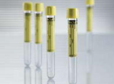Vacuette® Urinalysis Tube, 9 mL, 16 x 100 mm 455028