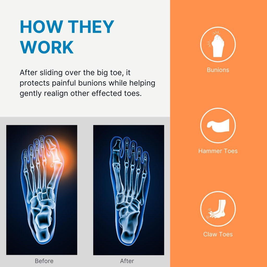 Gel Bunion Guard Spacer for Toe with Bunions
