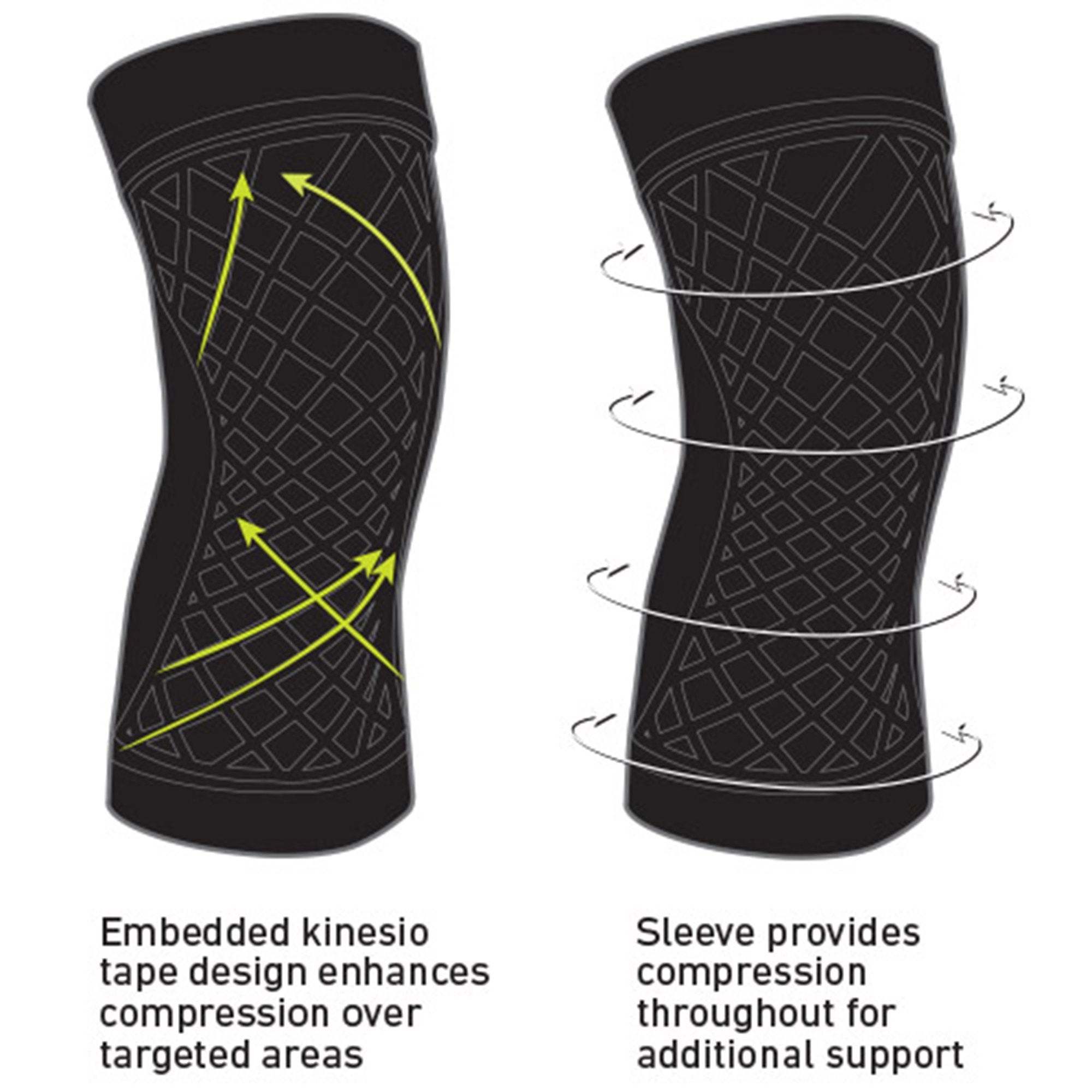 Spark Kinetic Knee Sleeve, Small 40410