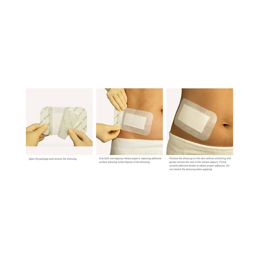 Mepore® Adhesive Dressing, 3-3/5 x 6 Inch 671000