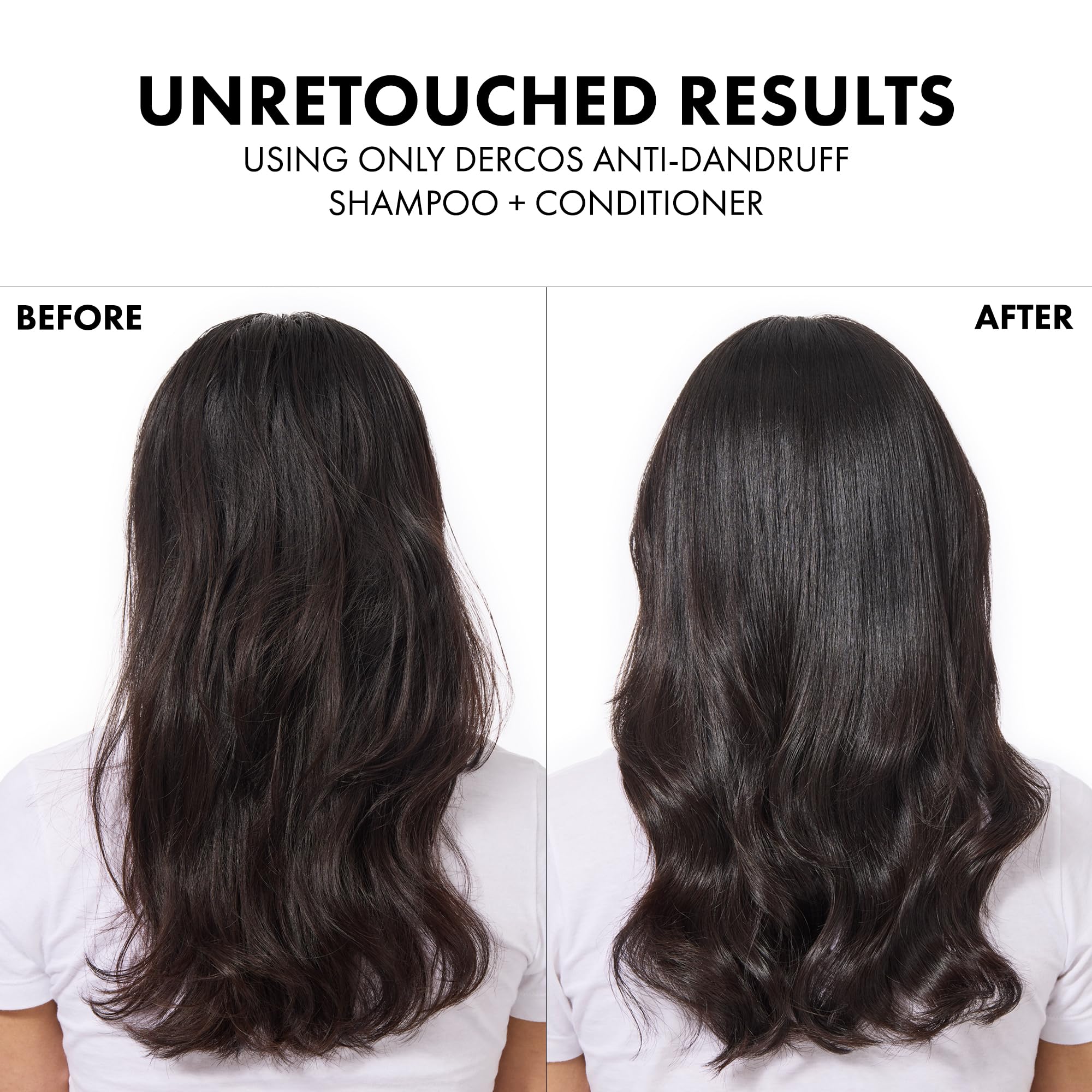 Vichy Dercos Densi-Solutions Thickening Shampoo for Thinning Hair - Strengthens, Thickens, and Stimulates Scalp - 13.53 fl oz
