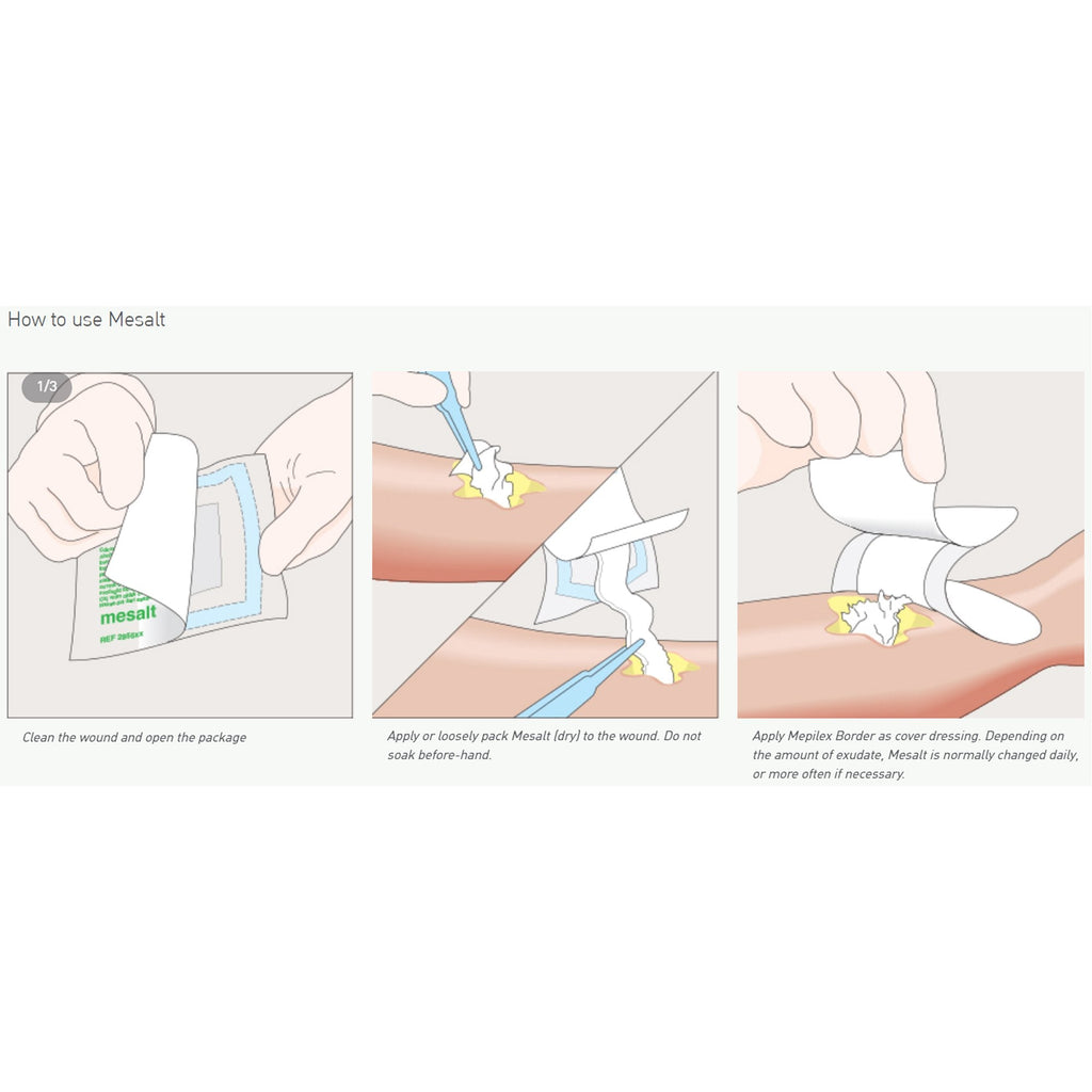 Mesalt® Sodium Chloride Impregnated Dressing, 4 x 4 Inch / 2 x 2 Inch Folded 285580