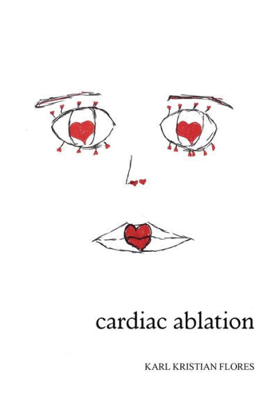 Cardiac Ablation