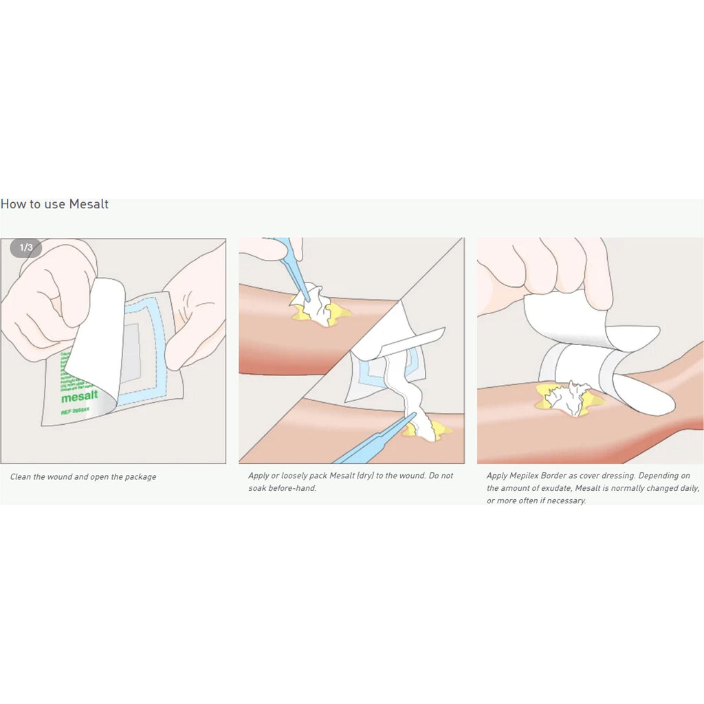 Mesalt® Sodium Chloride Impregnated Dressing, 6 x 6 inch 285780