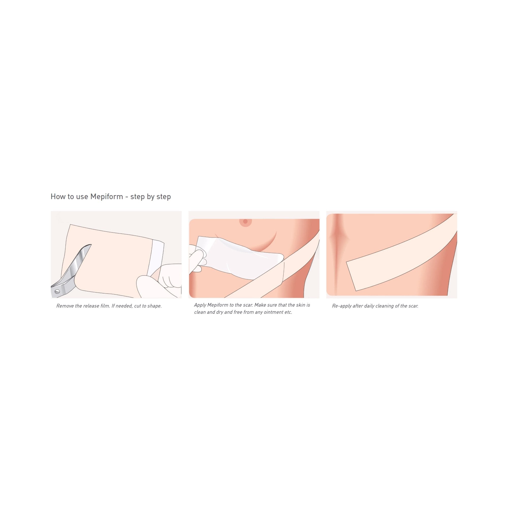 Mepiform® Self Adherent Silicone Dressing, 4 x 7 Inch 293499