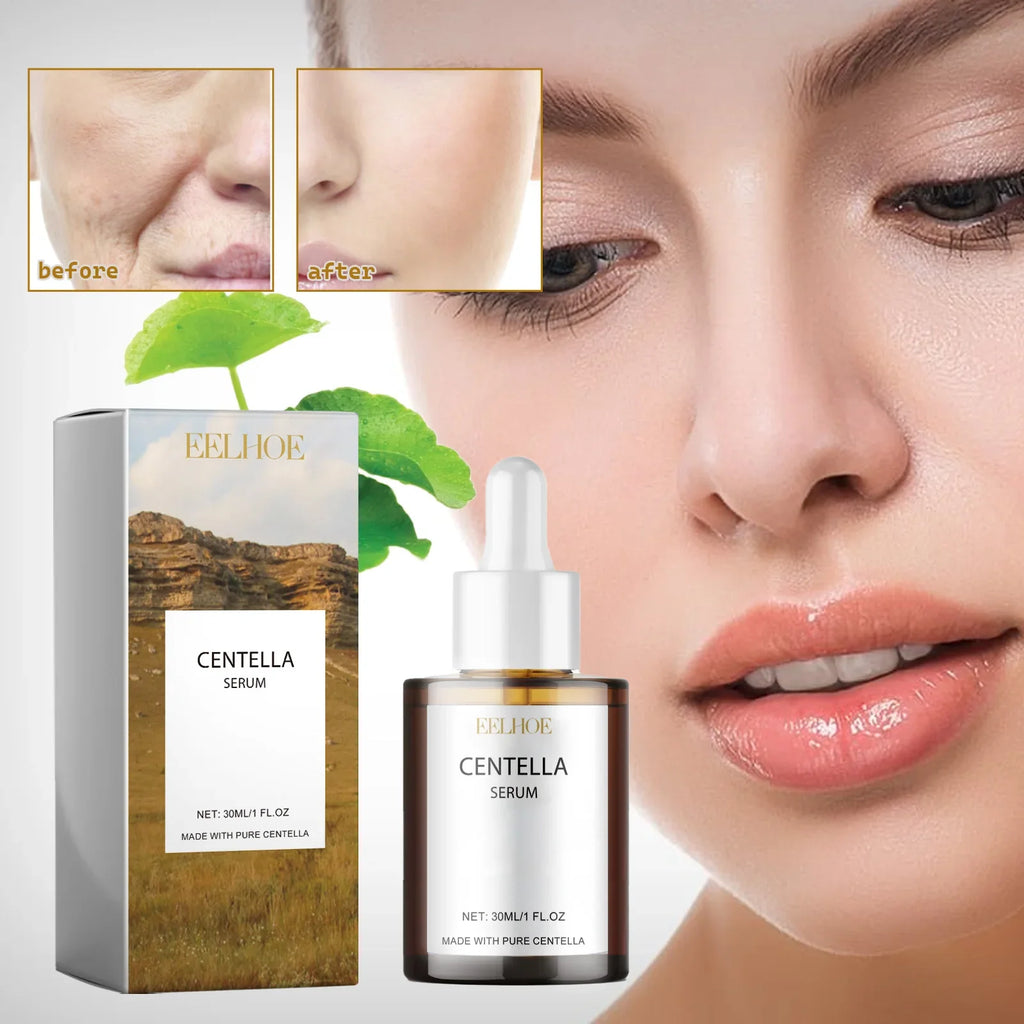 Centella Asiatica Skin Serum - Deep Moisturize & Replenish Care Essence Improve Skin Health Relieve Dry & Discomfort