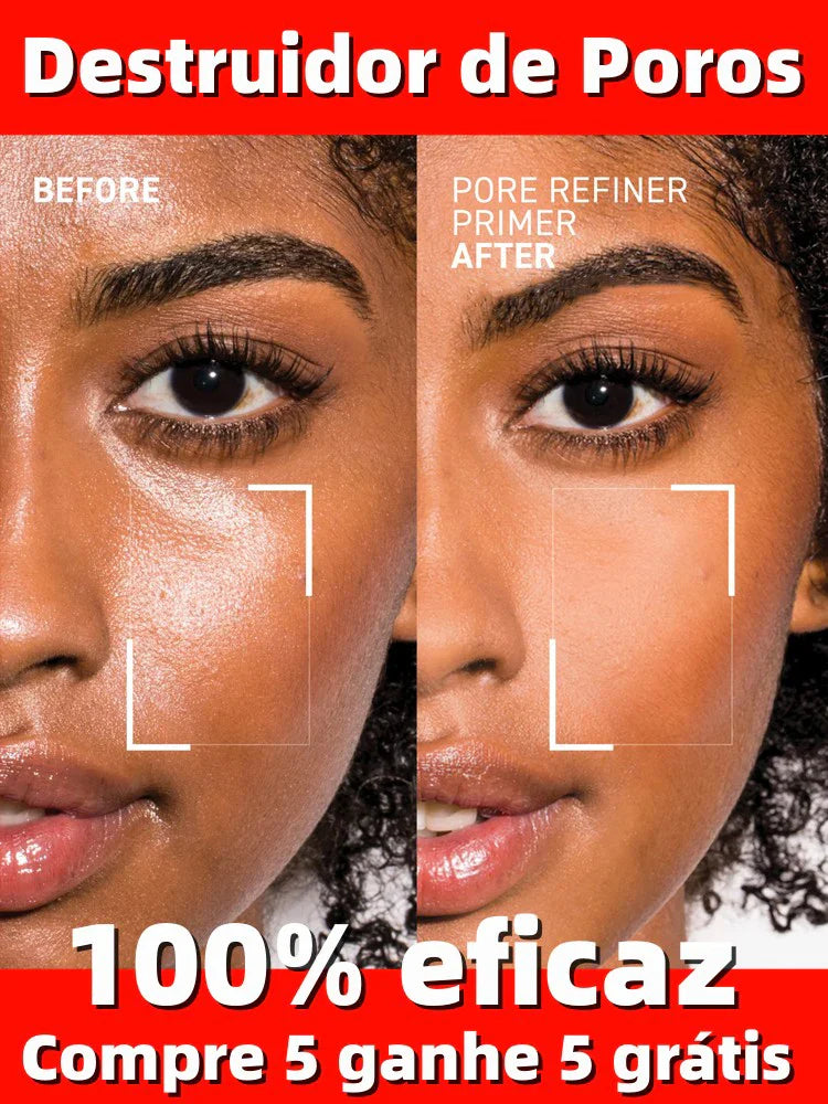 Acne Treatment Anti Aging Serum.