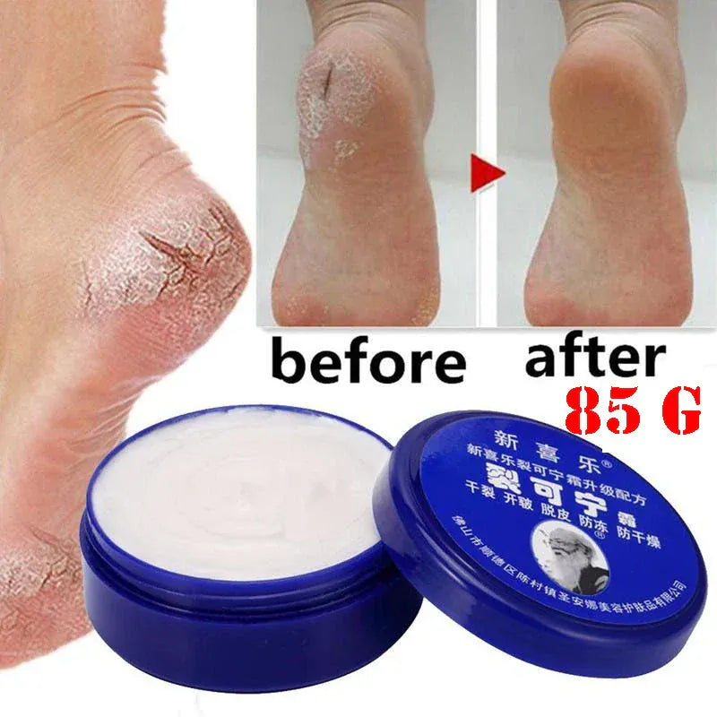 Feet and Hand Crack Removal Cream.