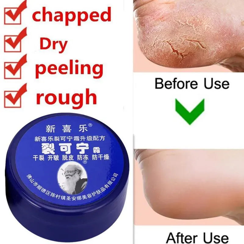 Feet and Hand Crack Removal Cream.
