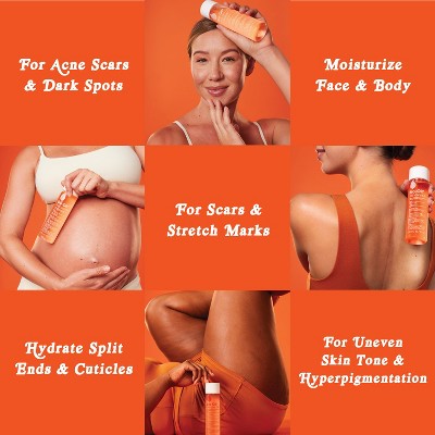 Bio-Oil Skincare Body Oil and Scar Treatment 4.2 fl oz - Imperfect Box