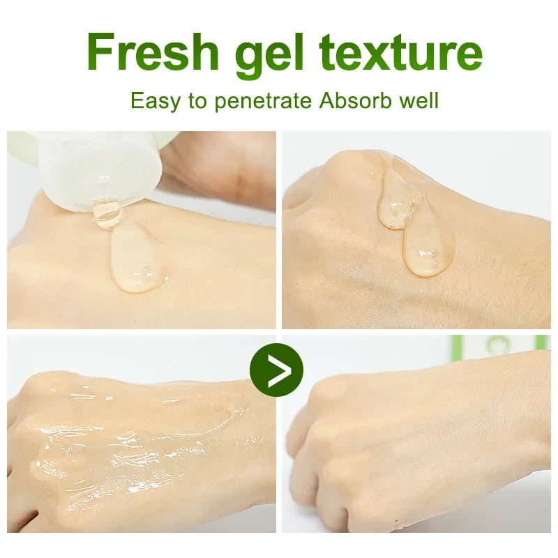 ENVISHA Aloe Vera Gel Soothing Moisturizing Hyaluronic Acid Sunburn Repairing Treatment Skin Care Face Body Cream Antipruritic