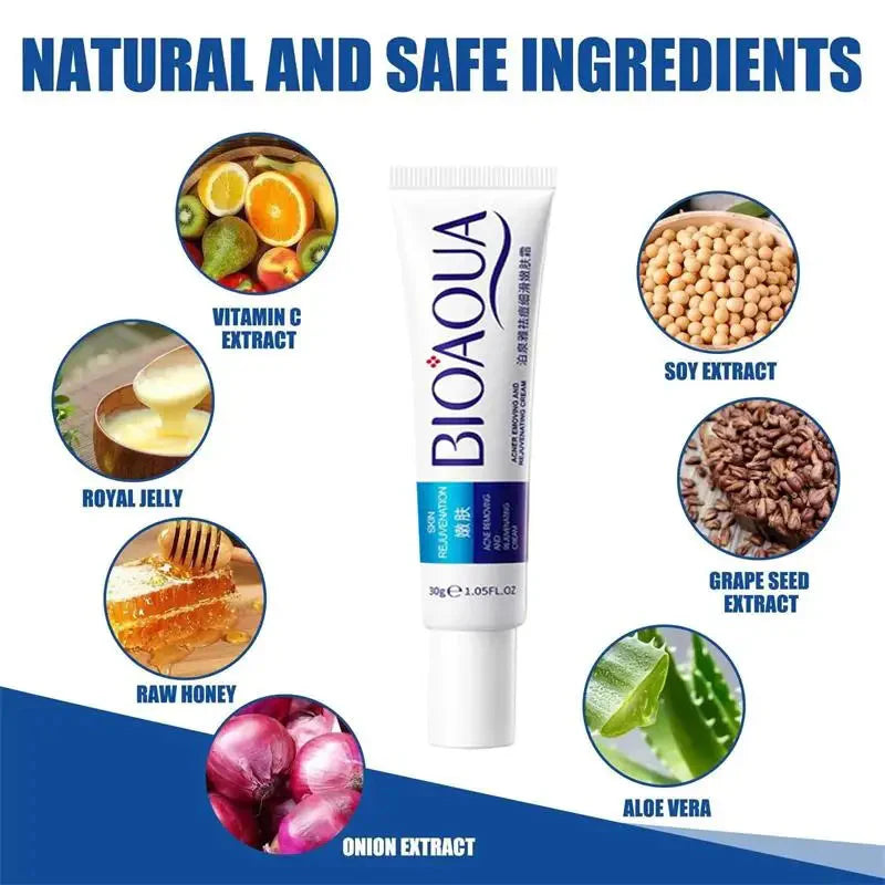 Herbal Acne Removal Face Cream.