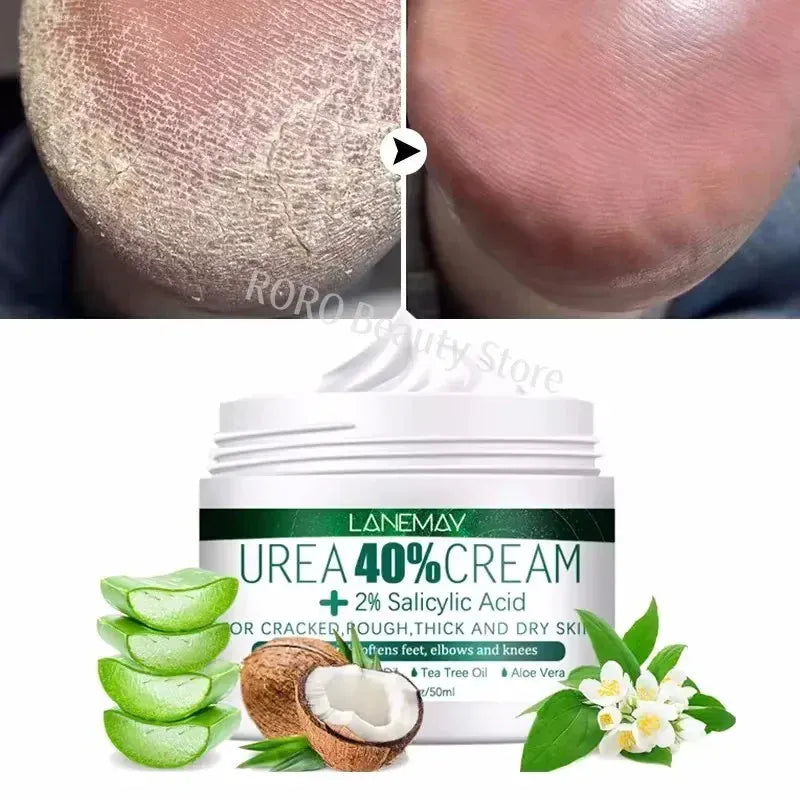 Herbal Anti Crack Foot Heel Cracking Repair Cream.