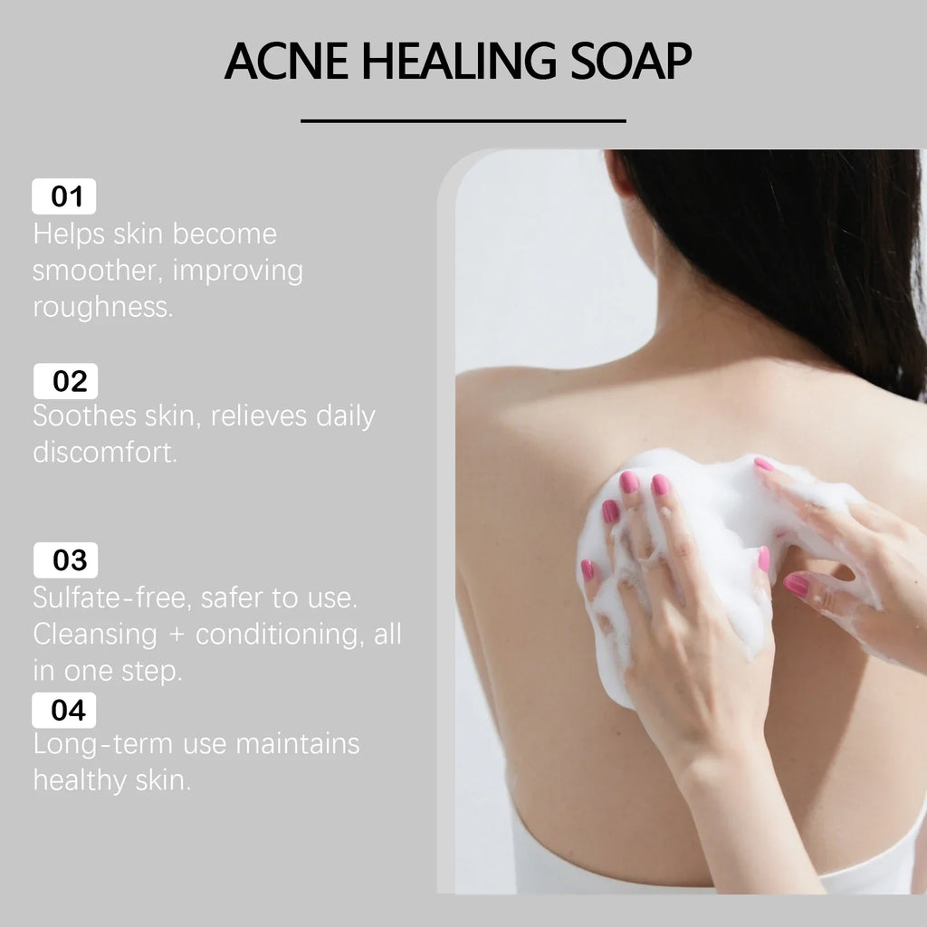 Body Cleansing Soap Moisturizing Brightening for Back Acne Free Natural Body Wash Bar Deep Clean Removes Odors Smooth Skin 100g