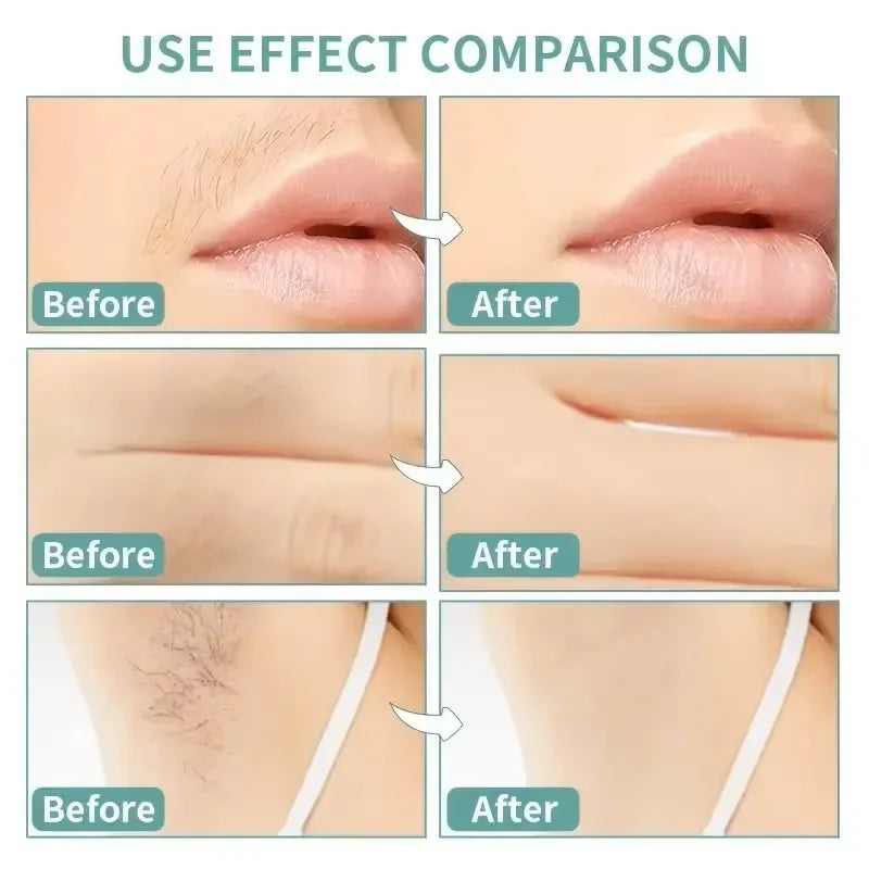20stick Professional Hair Removal Wax Strips for Summer Depilation Double Sided Cold Wax Paper for Leg Body Face Useful