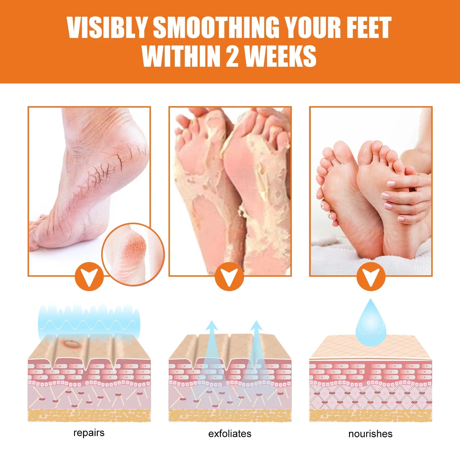 Jaysuing Foot exfoliating spray cleanses and removes dead skin to prevent dryness, nourish and moisturize foot skin care spray