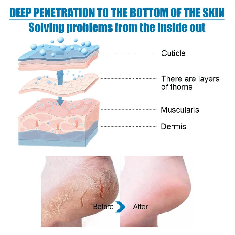 Exfoliating Foot Mask Feet Peeling Mask Spa Socks Smooth Dead Skin Remover Moisturizing Whitening Anti-Cracked Foot Skin Care