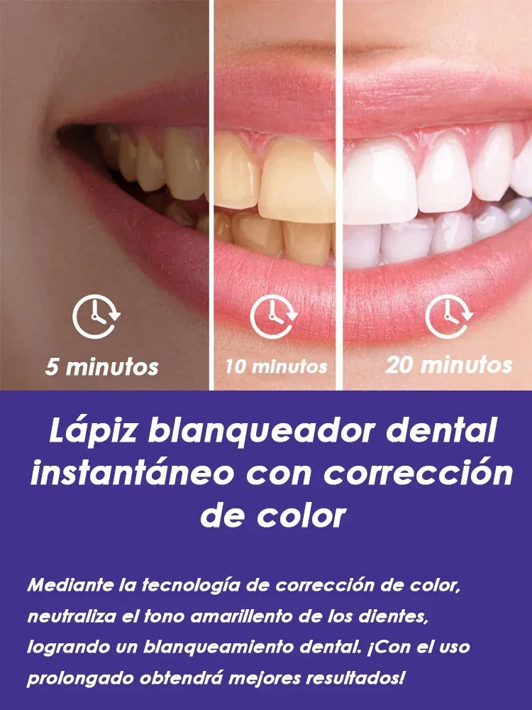 Purple Instant Teeth Whitening Pen Tartar Toothpaste Clean Teeth Stains No Sensitivity for Clearer Brighter Smile Cavity Care bd