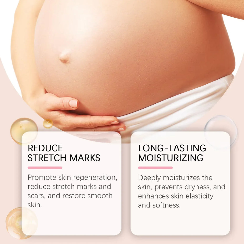 Pregnancy Stretch Marks Removal Cream Anti Fine Lines Repair Crack Firming Skin Eliminate Red White Old Pregnancy Marks Cream