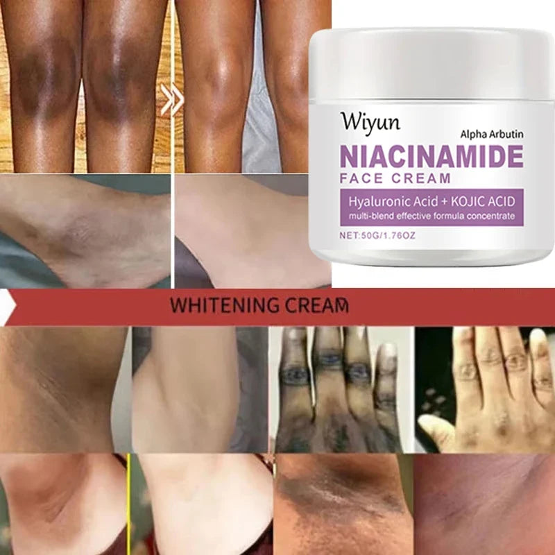 Body Whitening Cream Private Parts Underarm Bleaching Serum Whiten Butt Knee Brighten Inner Thigh Intimate Dark Remove Melanin