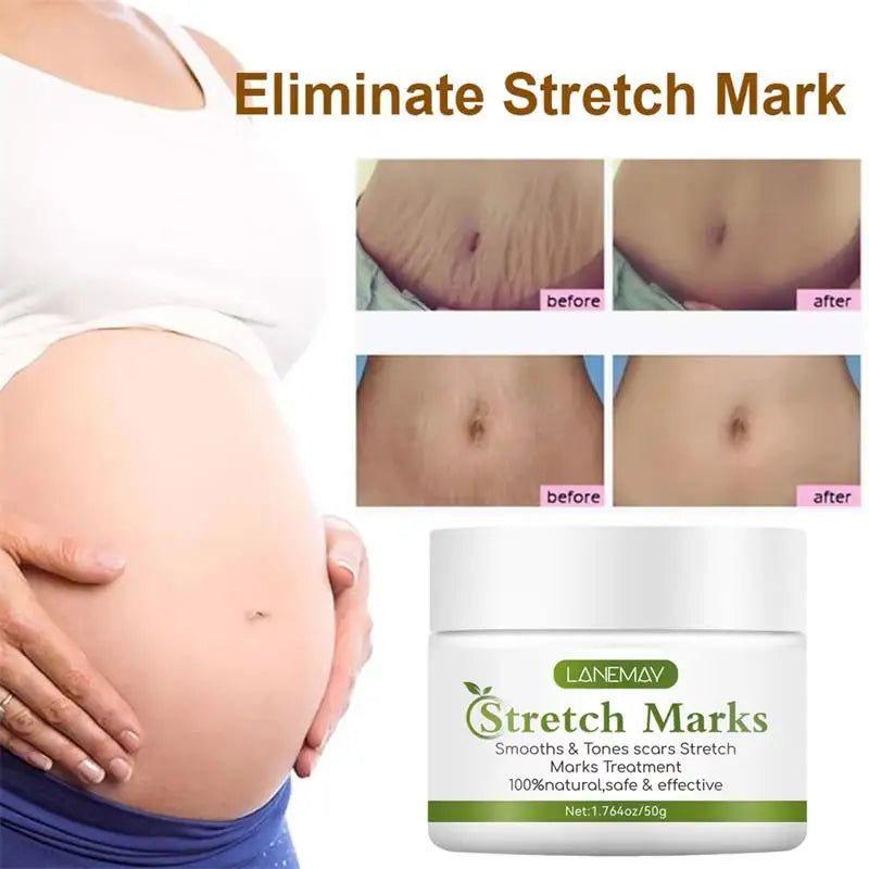 Stretch Marks Permanent Removal Cream Maternity Pregnant Women Pregnancy Anti-Winkle Smooth Repair Firming Skin Body Skin Care