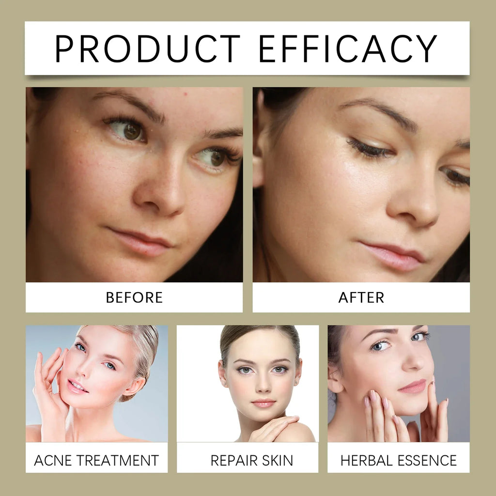 Glycolic Acid 7% Moisturizing Toner Remove Acne Improve Skin Condition Replenish Water Moisturize Skin Tender Skin&Toner Essence