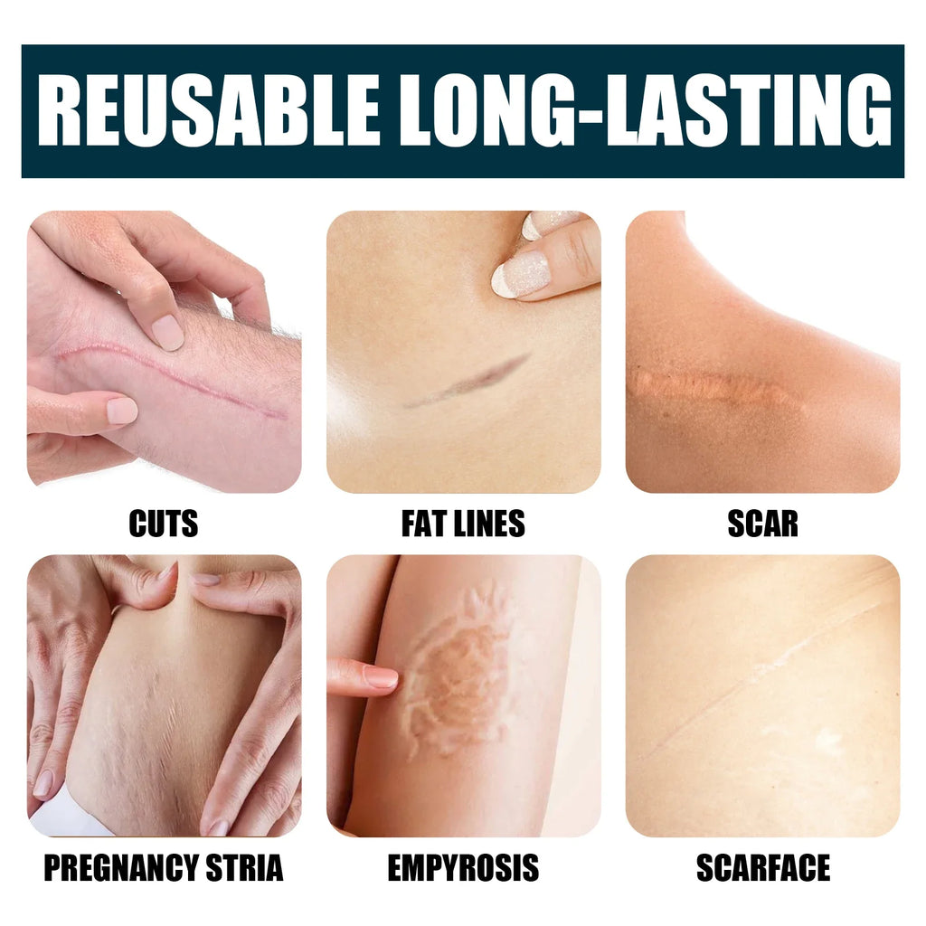 Skin Care Cream Scars Repair Gel Face Body Lotion Smoothing Hydrating Stretch Marks Cream Post Surgery Scar Care Gel Moisturize