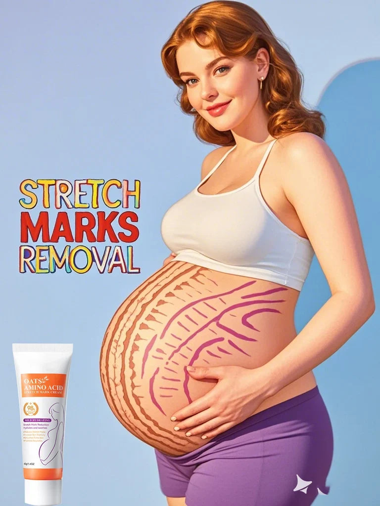 Cream For Pregnancy Stretch Marks Removal Eliminate Red White Old Stretch Marks 26