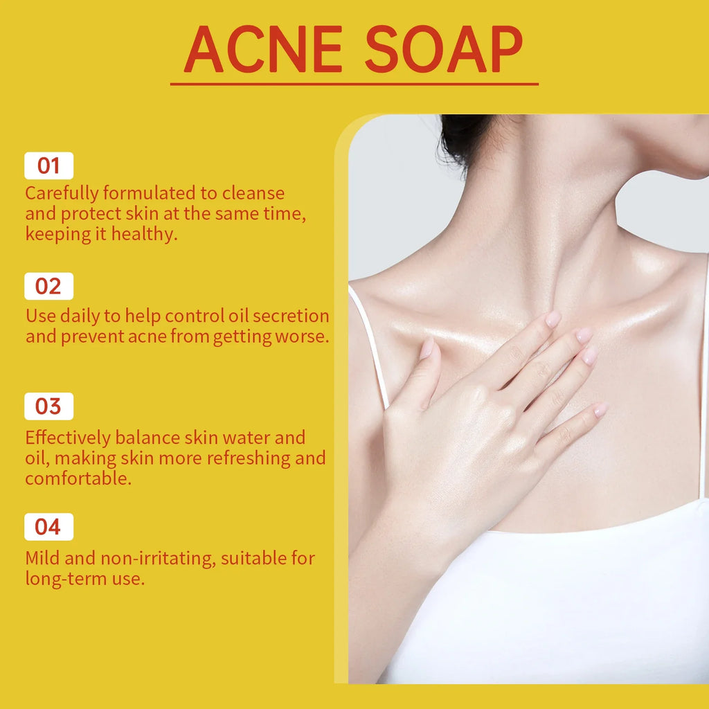 Acne Treatment Soap Pimple Remove Pigment Deep Cleansing Pores Shrink Oil Control Moisturize Body Face Lightening Skin Care Soap