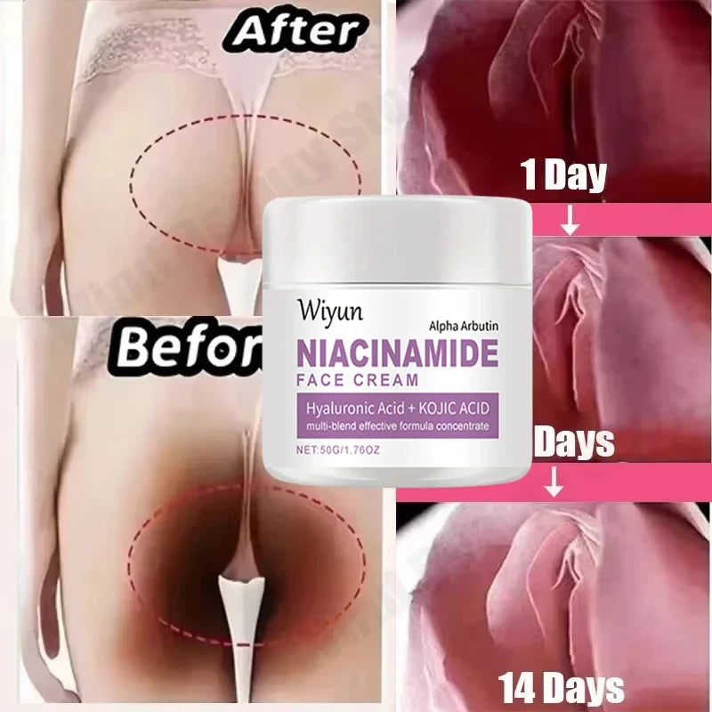 Body Whitening Cream Private Parts Underarm Bleaching Serum Whiten Butt Knee Brighten Inner Thigh Intimate Dark Remove Melanin