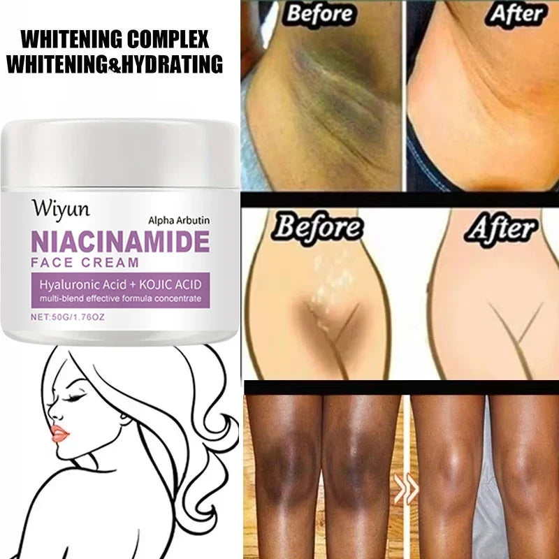 Body Whitening Cream Private Parts Underarm Bleaching Serum Whiten Butt Knee Brighten Inner Thigh Intimate Dark Remove Melanin