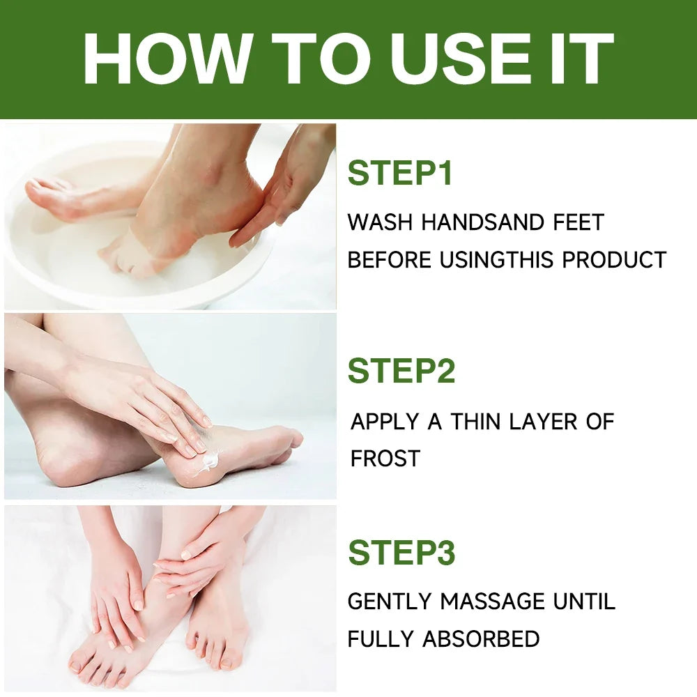 LEMON Foot Cream Heel Cracking Repair Products Exfoliation Dead Skin Removal Softening Moisturize Smooth Skin Care Natural Hand