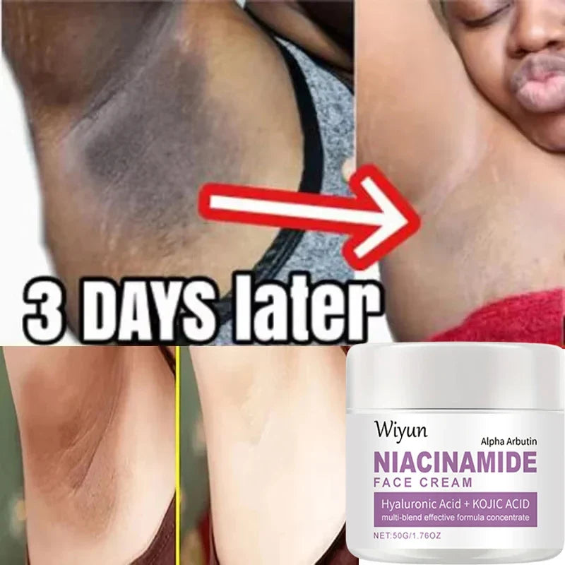 Body Whitening Cream Private Parts Underarm Bleaching Serum Whiten Butt Knee Brighten Inner Thigh Intimate Dark Remove Melanin