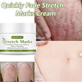 Stretch Marks Permanent Removal Cream Maternity Pregnant Women Pregnancy Anti-Winkle Smooth Repair Firming Skin Body Skin Care