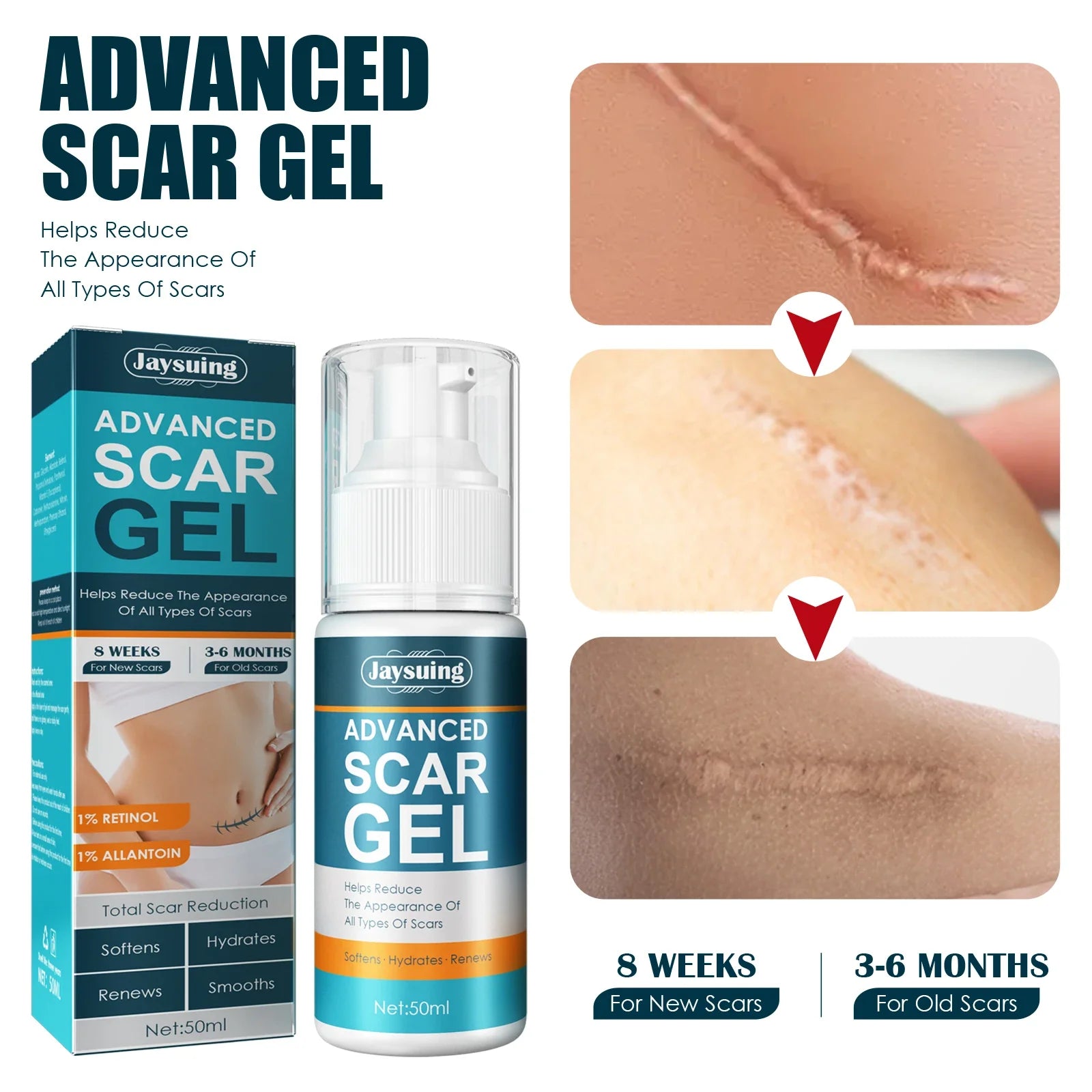 Skin Care Cream Scars Repair Gel Face Body Lotion Smoothing Hydrating Stretch Marks Cream Post Surgery Scar Care Gel Moisturize