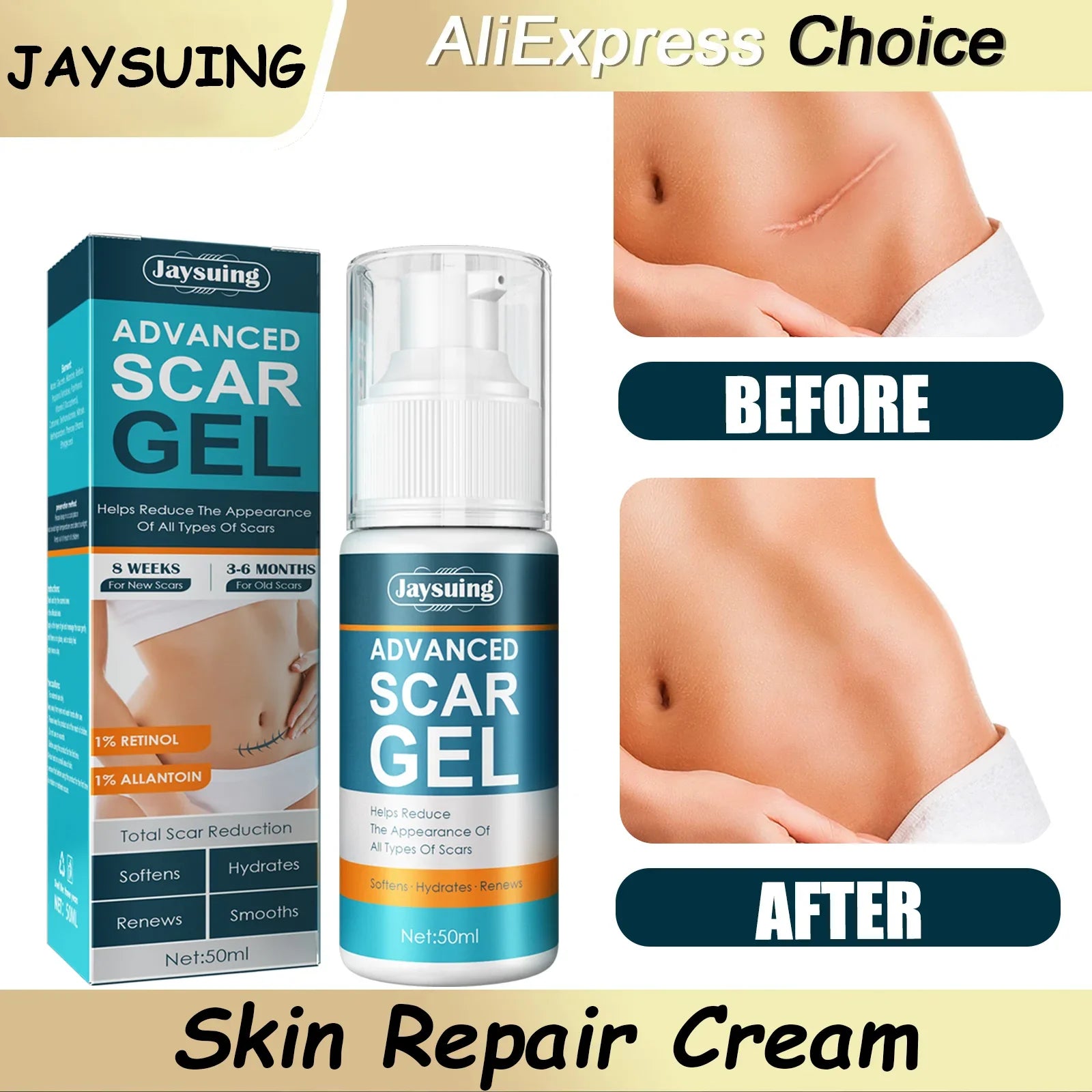 Skin Care Cream Scars Repair Gel Face Body Lotion Smoothing Hydrating Stretch Marks Cream Post Surgery Scar Care Gel Moisturize