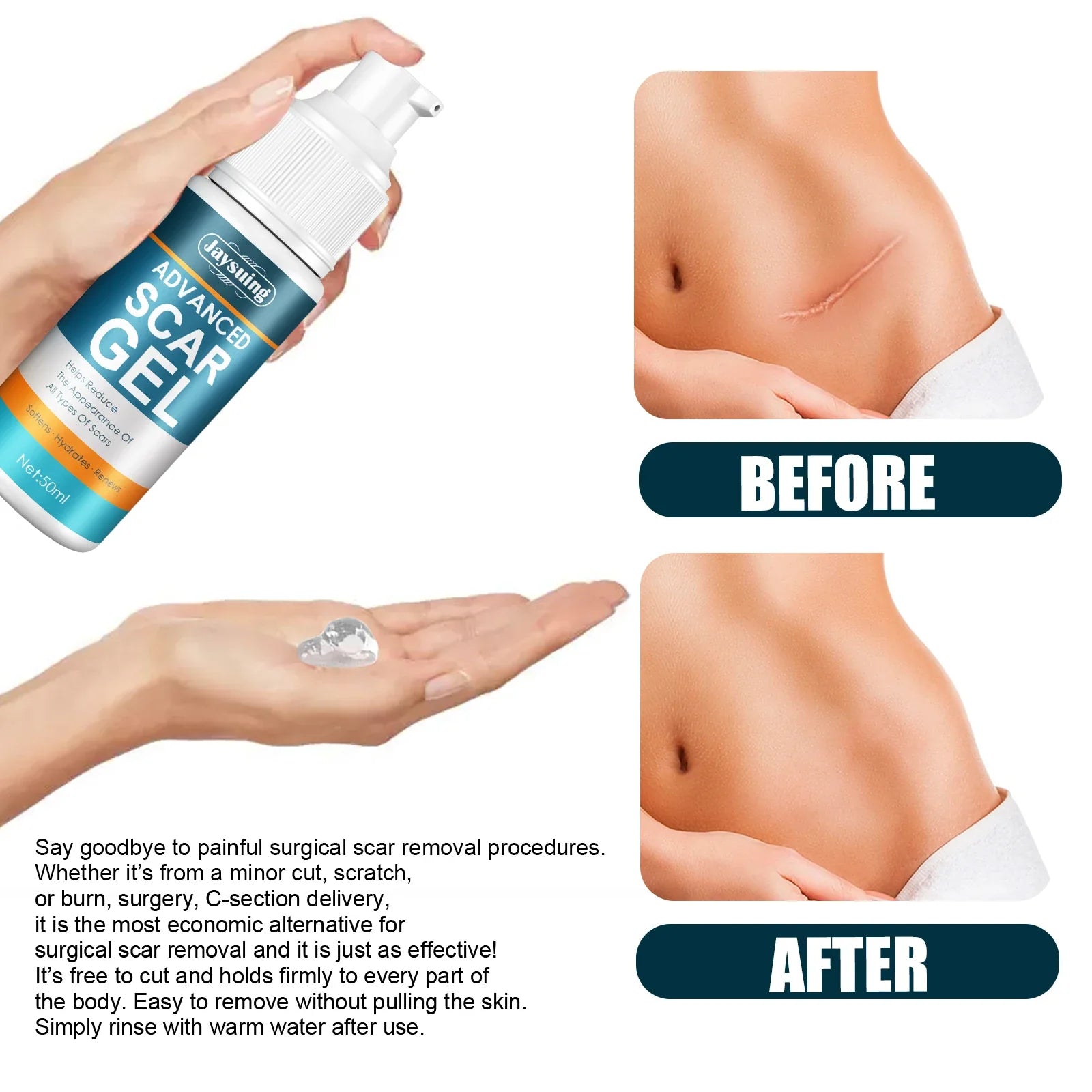 Skin Care Cream Scars Repair Gel Face Body Lotion Smoothing Hydrating Stretch Marks Cream Post Surgery Scar Care Gel Moisturize