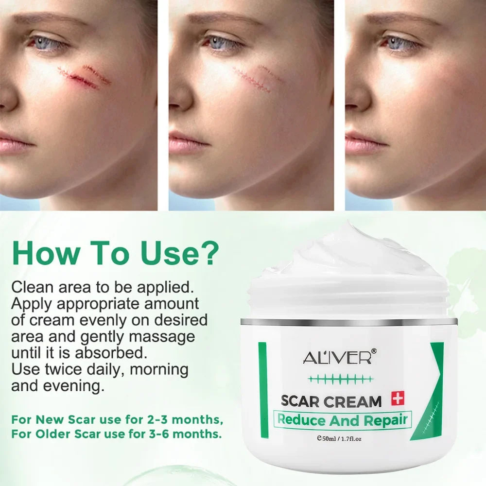 ALVER Acne Scar Stretch Marks Remover Cream Skin Repair Acne Black Dots Spots Acne Treatment Blackhead Bleaching Cream 50ml