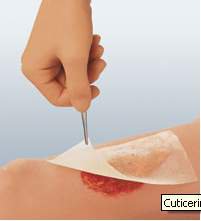 Cuticerin Oil Emulsion Impregnated Dressing, 3 x 8 Inch 66045561