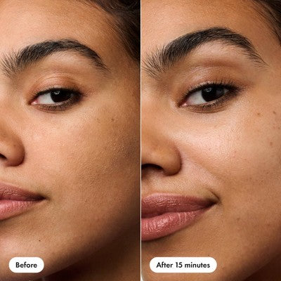 Hero Cosmetics Rescue Patch 6ct - New - PhishStones Products