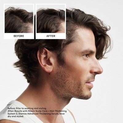 Nioxin System 2 Hair Thickening Natural & Untreated Hair Shampoo & Conditioner Kit 3ct - New - PhishStones Products