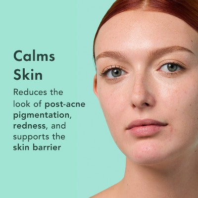 Rael Miracle Clear Complete Acne Treatment Face Serum 1oz - New - PhishStones Products