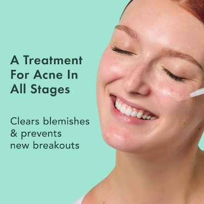 Rael Miracle Clear Complete Acne Treatment Face Serum 1oz - New - PhishStones Products