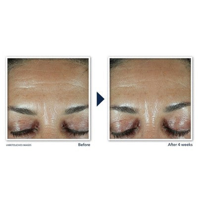 RoC Retinol Correxion Deep Wrinkle Filler 1 fl oz - New - PhishStones Products